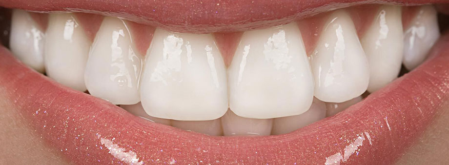 Zahnimplantate - Investition in Ihre Gesundheit 1