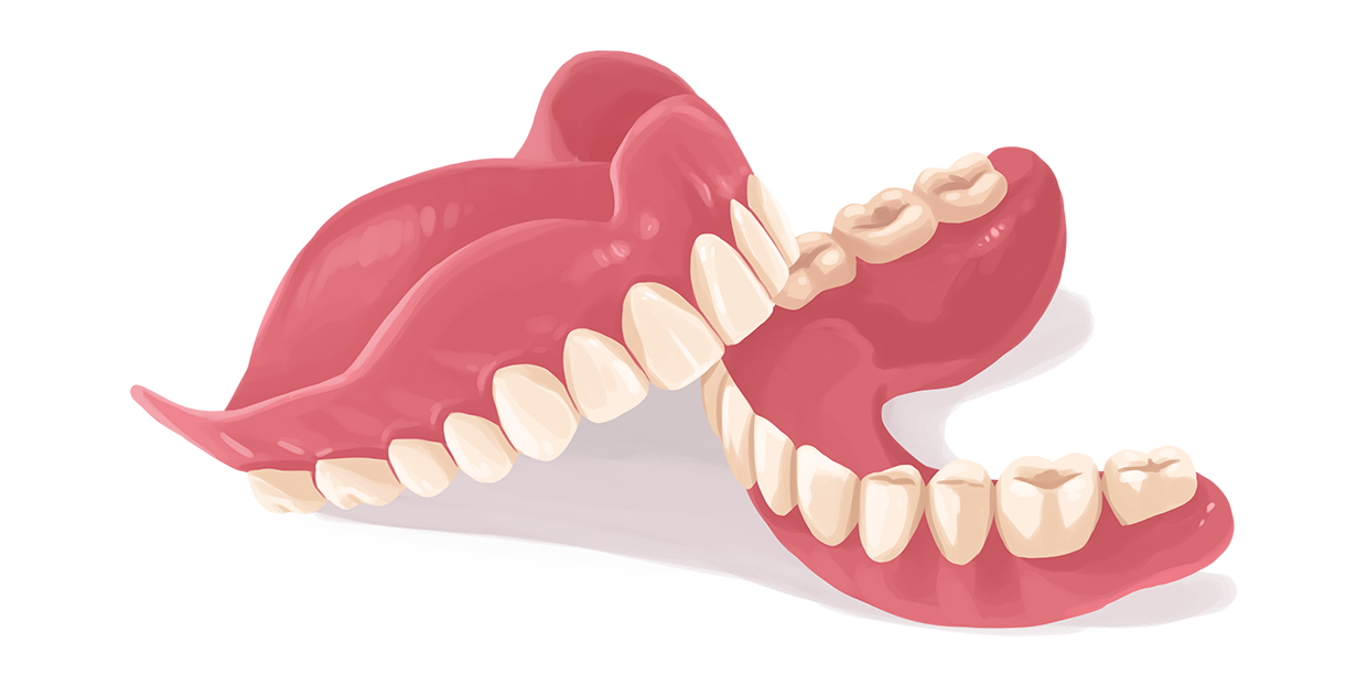 Zahnprothese und Teilprothese 1